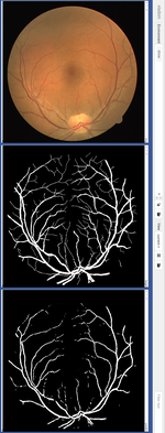 Comparison of Capsule Networks and Other Networks for Object Segmentation Tasks